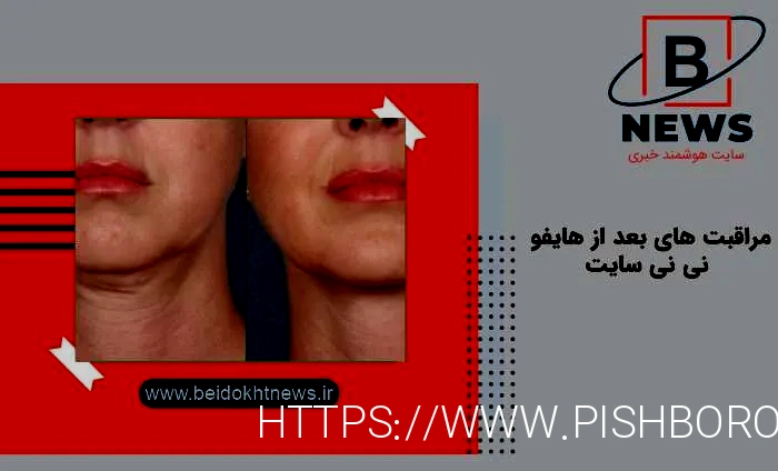 بهترین دکتر هایفو نی نی سایت
