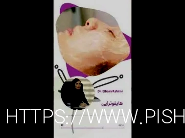 آر اف بهتر است یا هایفو