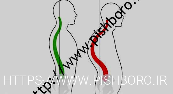 نهنگ های گوژپشت را در خانه با چند مرحله ساده درمان کنید